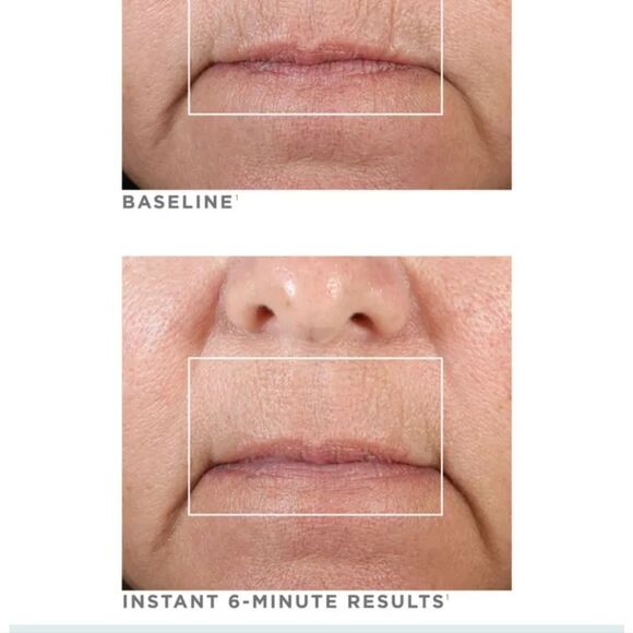 NuFace Fix Line Smoothing Device - Picture 8 of 12